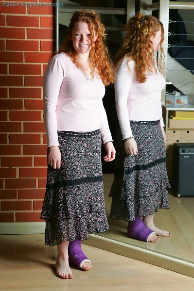 Bernadette in a cast - 1/16 Bernadette in a cast from abbywinters.com - 1/16