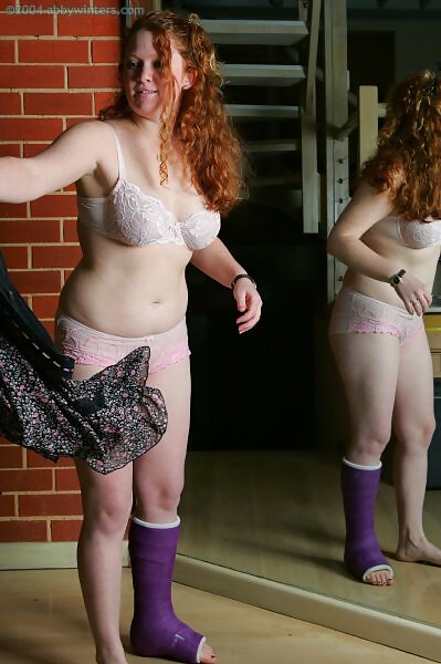 Bernadette in a cast - 4/16 Bernadette in a cast from abbywinters.com - 4/16