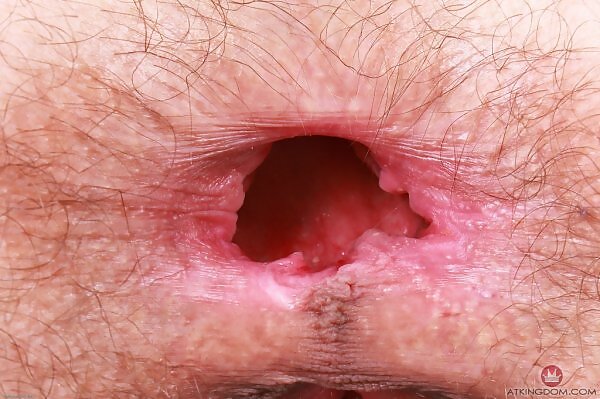 Sia Wood in striped socks - 10/20 Sia Wood in striped socks from ATK Hairy - 10/20