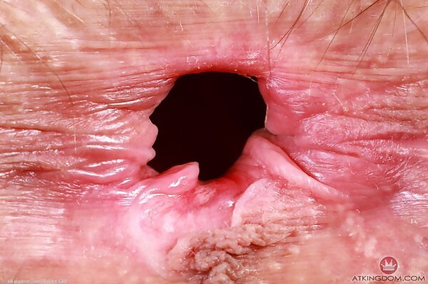 Sia Wood is a hairy young vixen - 20/18 Sia Wood is a hairy young vixen from ATK Hairy - 20/18