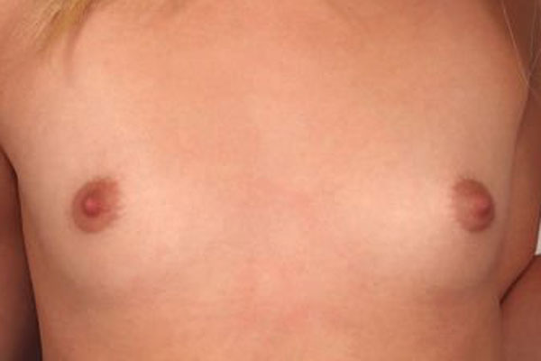 Emma Bugg tits closeup
